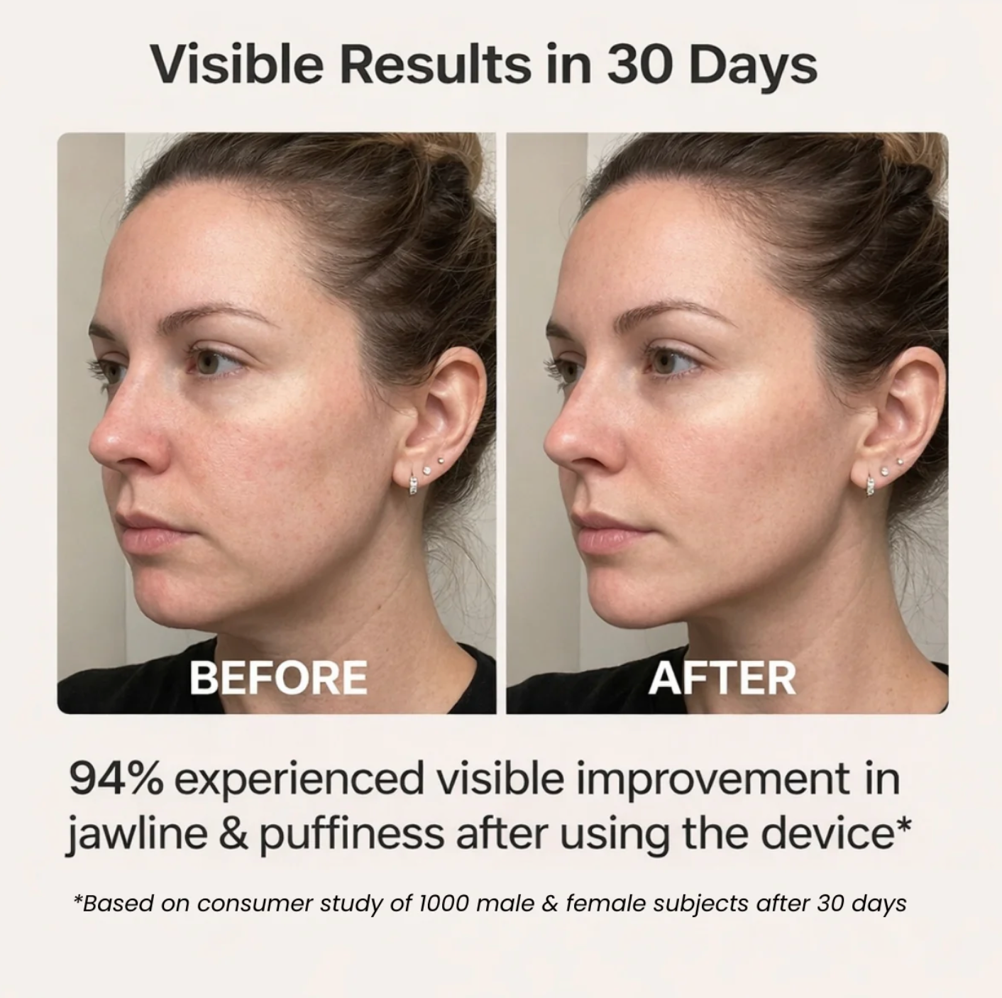 Auréa LiftSculpt™ Facial Device