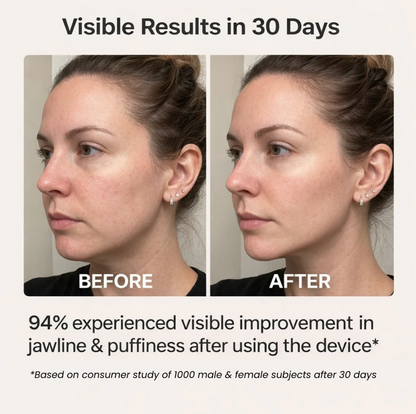 Auréa LiftSculpt™ Facial Device